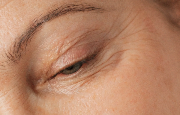 Wrinkles Guide (available in russin language only)